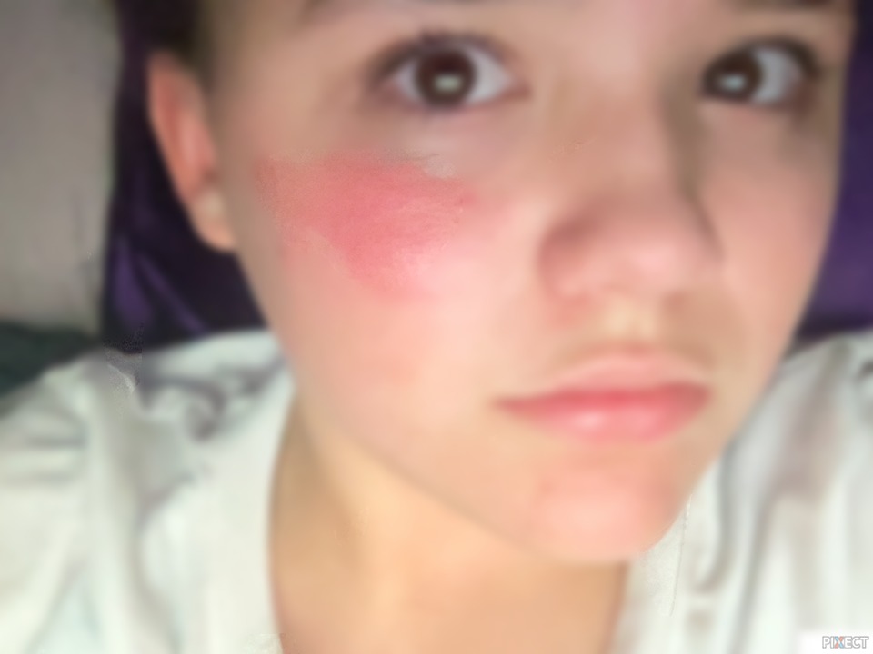 Pixect gallery photo #25Y6rCd