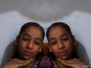 WE BOTH ARE TWINS WE BOTH ARE TWINS