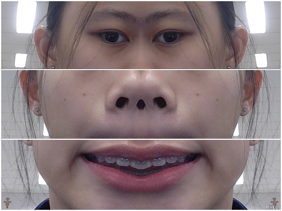 Pixect gallery photo #MeAuhcmd9