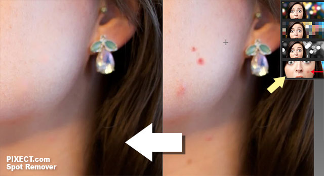 Remove spots from skin photos with Pixect Spot Remover